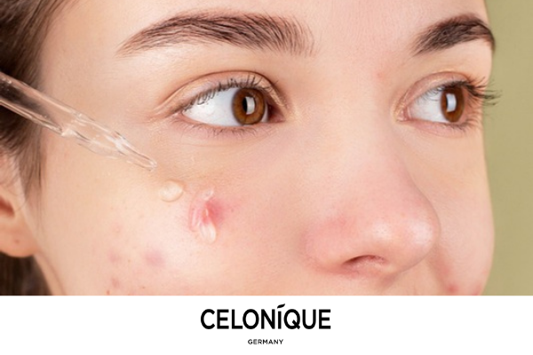 Woman applying facial serum with a glass dropper, with the CELONIQUE Germany logo below.