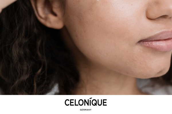 Close-up of a woman applying skincare serum to her face, with CELONIQUE Germany branding.